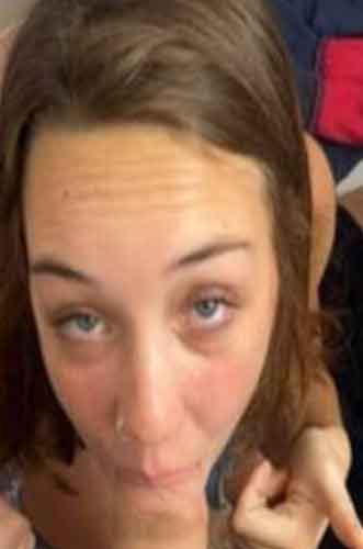 Hanne, 28 år